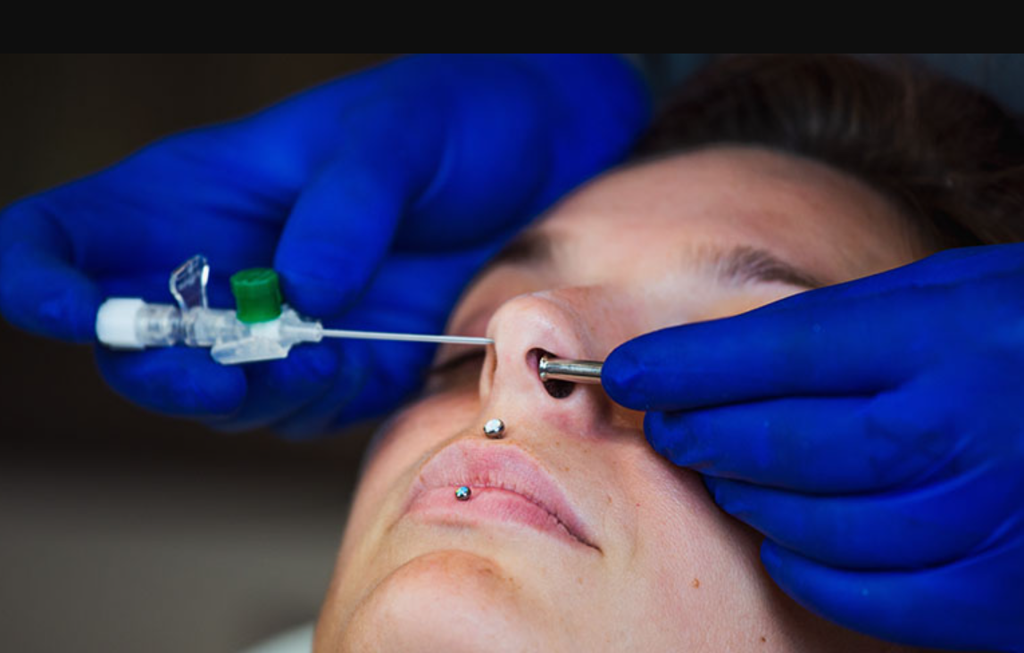 xo-khuyen-vach-ngan-mui-1