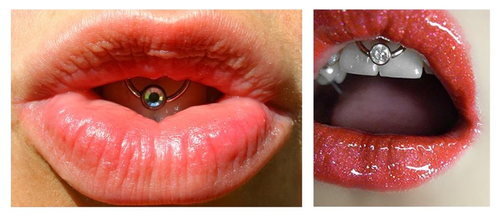 xo-khuyen-vung-ran-tren-1